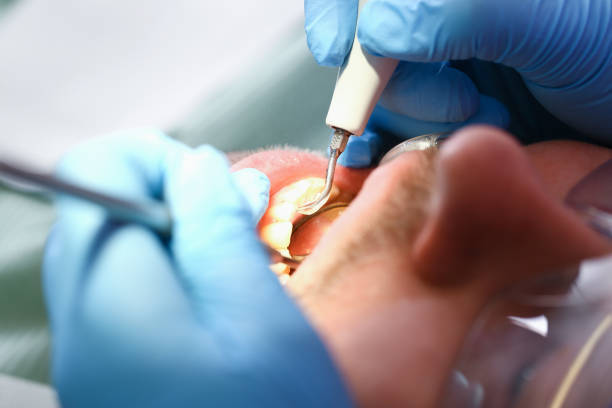 Best Emergency Cosmetic Dentistry (e.g., broken veneers) in Orlinda, TN