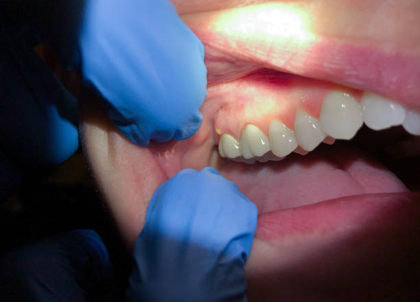 Best After-Hours Dental Care in Orlinda, TN
