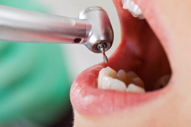 Best Emergency Denture Repair in Orlinda, TN